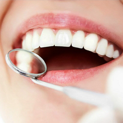 Caries treatment in Odessa